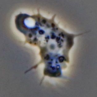 Acanthamoeba