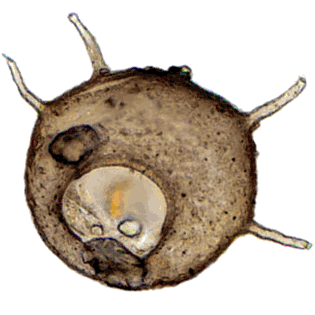 Centropyxis aculeata