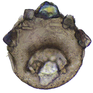 Centropyxis discoides