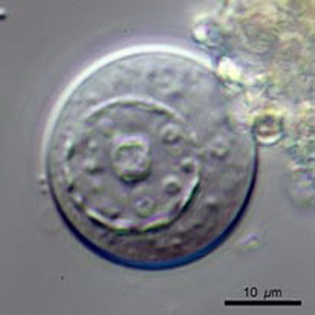 Cucurbitella mespiliformis