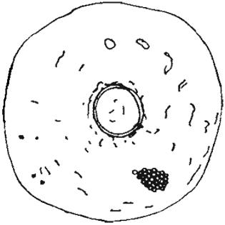 Cyclopyxis aplanata microstoma