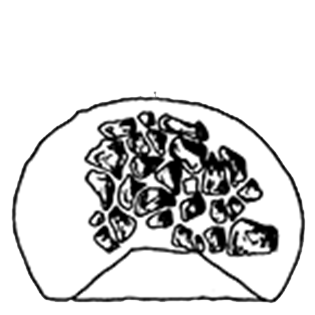 Cyclopyxis eurystoma stenostoma