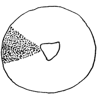 Cyclopyxis triangularistoma