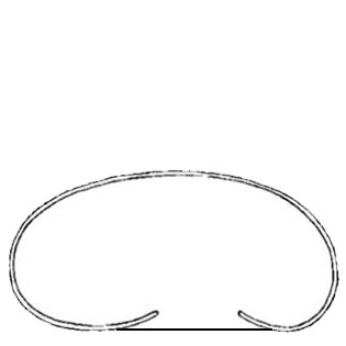 Cyclopyxis trilobata