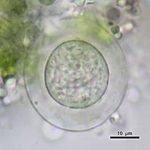 Difflugia gramen