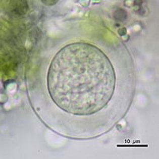 Difflugia gramen