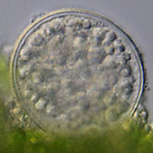 Difflugia amphora