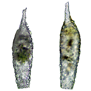 Difflugia giganteacuminata