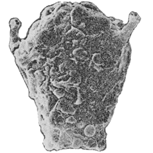 Difflugia juzephiniensis