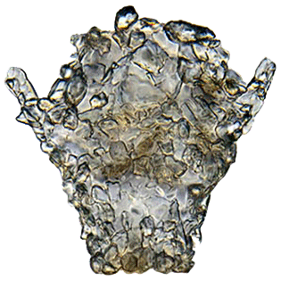Difflugia leidyi