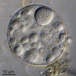 Difflugia lobostoma