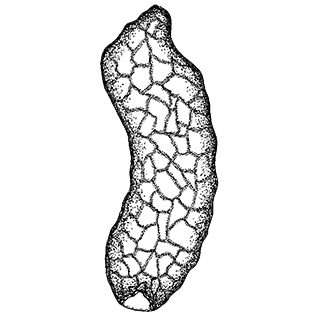 Difflugia vermiformis