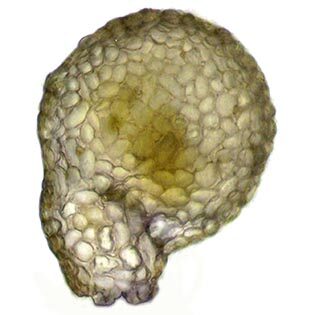 Lesqureusia-spiralis-hans