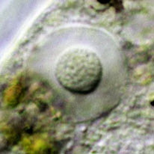 Mayorella augusta