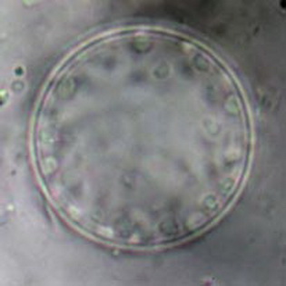 Pelomyxa