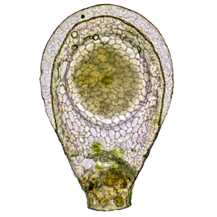 Planocarinata