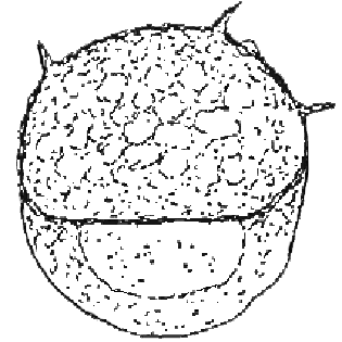 Centropyxis cassis spinifera