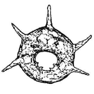 Centropyxis aculeata dentistoma