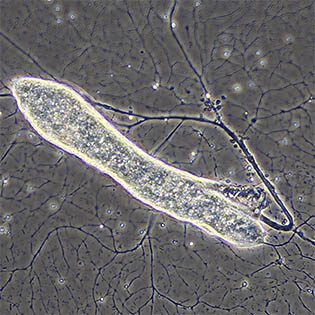 Granoreticulose